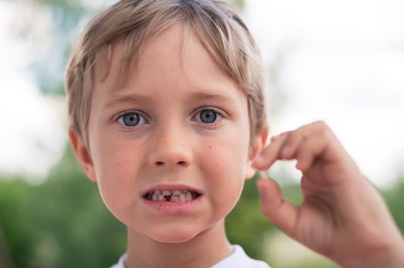 Traumatismos dentales en niños