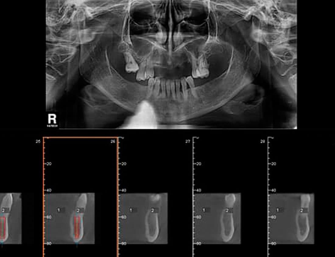 Expertos en radiología oral